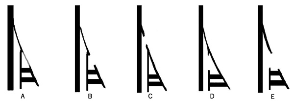 Five different states of the lower left frame junction line